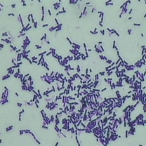 mikroskopski prikaz mlecno kisleinskih bakterija
