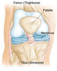Physical Therapy for Meniscal Tears