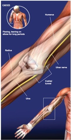 arm anatomy - Cupital tunnel syndrome